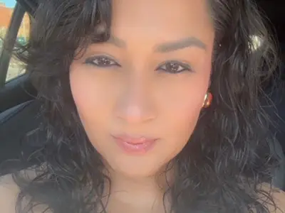 Mum's agonising undiagnosed condition causes skin colour change and weight gain