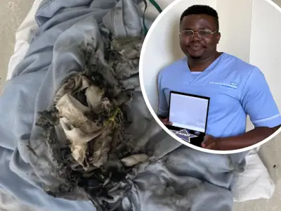Nurse Honoured for Saving Patient Who Set Head on Fire by Vaping