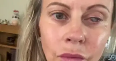 UK Mum's Eye Eaten by Parasites After Washing Face with Contact Lenses