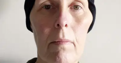 Woman Mistook Leukaemia Symptoms for Menopause, Rushed to Hospital