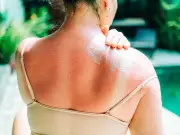 76% of Brits Use Sun Cream Abroad but Skip SPF at Home, Study Finds