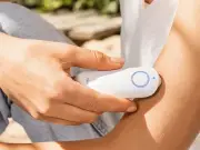 Beurer BR60 Insect Bite Healer: £30 Device Recommended by Expert