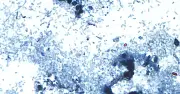 CDC Reports 843 Cases of Cyclospora Causing Explosive Diarrhea Across 31 US States