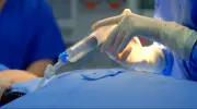 Channel 4 Reveals 'Lunchtime Boob Jobs' in Surgery Secrets of the Super Rich