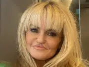 Danniella Westbrook shows off results of latest facial reconstruction surgery