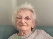 Daughter finds mum, 81, covered in bruises at Glasgow care home