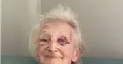 Daughter's horror after finding mum covered in bruises at UK care home