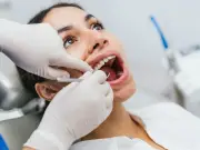 Dentist warns chewing ice in heatwave could lead to £300 dental bill