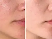 Dr Sam's New Moisturiser Gets Rave Reviews: 'Better Than 5-Year Fave'
