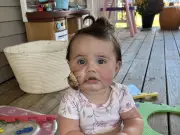 Family Dog Rips Chunk from Baby's Cheek in 'Targeted' Attack