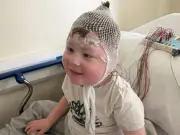 Five-Year-Old Boy Diagnosed with Rare Genetic Condition BPAN