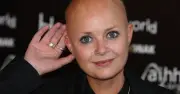 Gail Porter shows horror injuries after falling down Tube station stairs