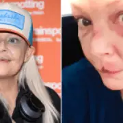 Gail Porter suffers facial injuries after Tube station fall