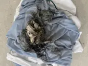 Hospital Issues Warning After Patient's Vape Causes Fire While on Oxygen