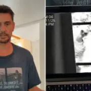 James Franco Reveals Bizarre 'Alien' in Garage, Viewers Say He's Lost His Mind