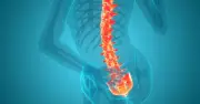 Labour Accused of Hiding Osteoporosis Scandal, 40,000 May Die Needlessly