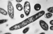 Legionnaires' Outbreak in NYC: 28 Sickened, Climate Change Blamed