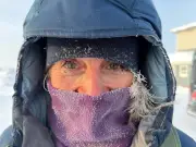 Louise Minchin unsure of long-term recovery after frostbite