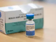 Measles Death in Adult Prompts UK Vaccination Urgency Amid Rising Cases