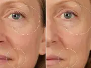Medik8 cuts 20% off anti-ageing serum that claims to reduce lines in 10 minutes