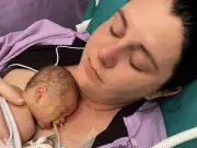 Mother told baby had one hour to live; he lifted his head and survived