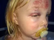 Mother Vows Never to Return Toddler to Nursery After Two-Metre Fall