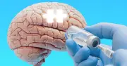 New Dementia Drug Trontinemab Trial Could Stop Alzheimer's Before Symptoms