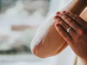 NHS Heat Rash Symptoms and When to See a GP During Heatwave