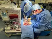 NHS organ-saving pilot enables first transplant, set to save hundreds
