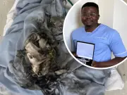 Nurse Honoured for Saving Patient Who Set Head on Fire by Vaping