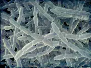 NYC Takes Emergency Measures After 46 Fall Ill in Legionnaires' Outbreak