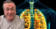Revolutionary COPD Jab Dupilumab Rolled Out on NHS for 30,000 Patients