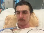 Robot vacuum explosion leaves man with 75% burns, mum reveals horror