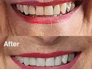 Teeth Whitening Powder at 32p a Use Boosts Confidence, Shoppers Say