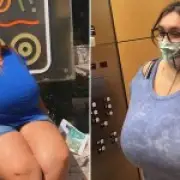 Texas Woman Loses Nipples After Breasts Grow From DD to P Cup in 4 Years