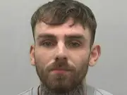 TikTok Meet Punch Leaves Man with Broken Jaw and Eye Socket