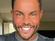 TOWIE Star Bobby Norris Warns Against Filler Abuse After Facelift