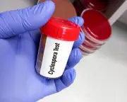 Trump's Public Health Cuts Hinder Record US Cyclosporiasis Outbreak Response