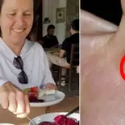 Woman bitten by bat on holiday saved from rabies after using Google Lens