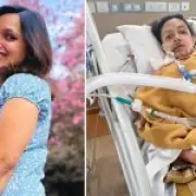 Woman Loses Part of Face in Tractor Crash After Seeking Depression Cure in India