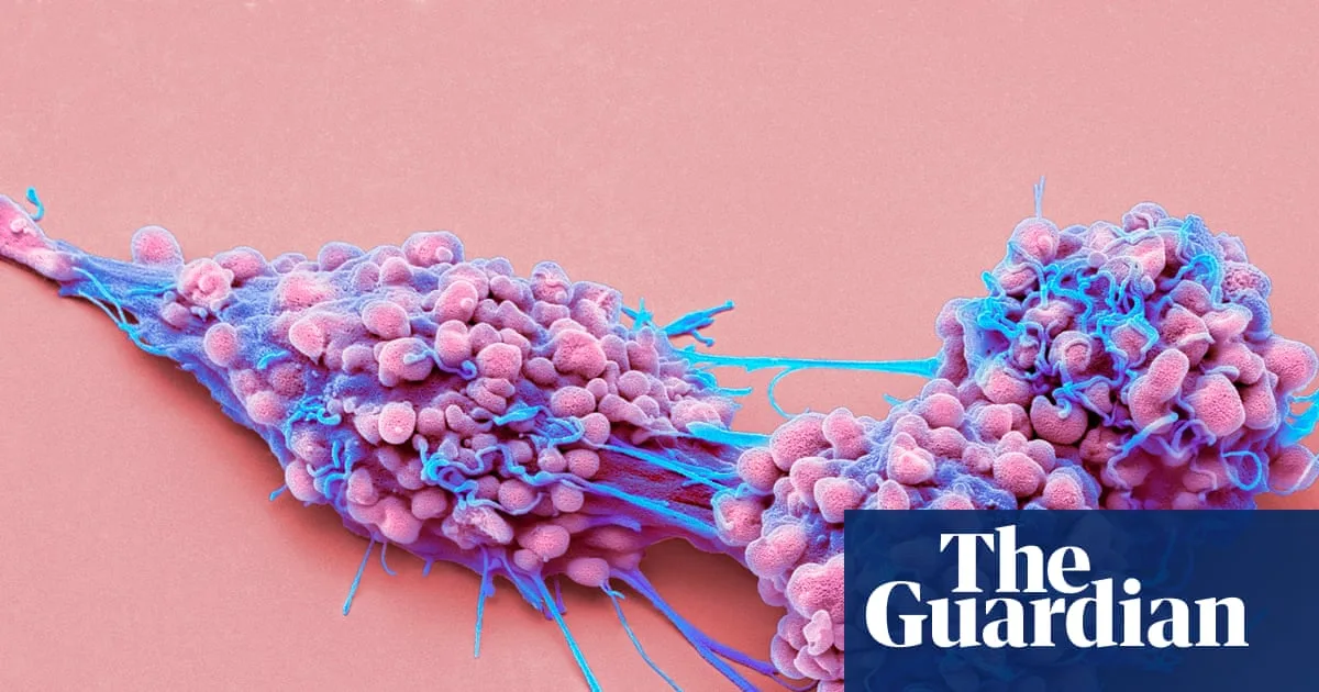 NHS Approves First New Drug for Resistant Ovarian Cancer in Over 20 Years
