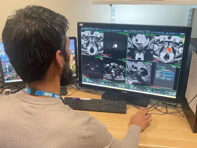 AI Tool Rolled Out in Greater Manchester to Speed Up Prostate Cancer Diagnosis