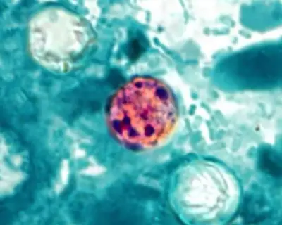 Cyclospora outbreak kills two in Michigan, officials say
