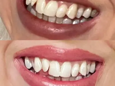 Manchester Dentist's Teeth Whitening Powder Boosts Confidence