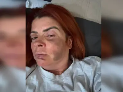 Manchester woman attacked by 'perfect' partner shares story