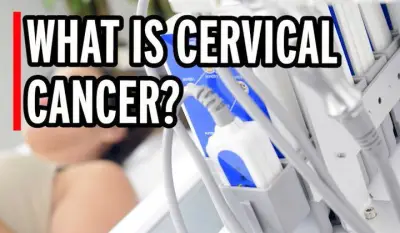 Millions of women to get free at-home cervical cancer screening kits on NHS