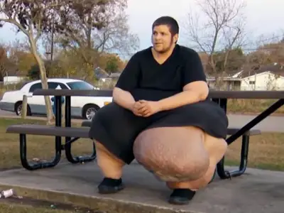 My 600lb Life star JT's 100lb growth ordeal and his life now