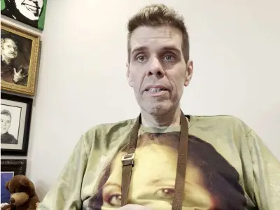 Perez Hilton Hospitalized After Bloody TikTok Livestream