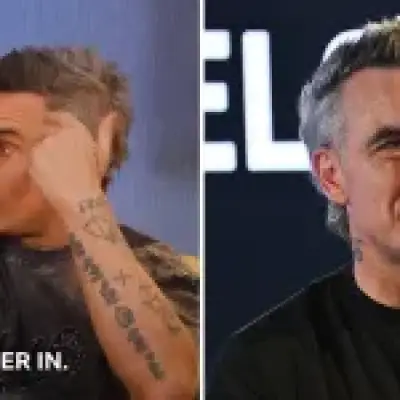 Robbie Williams considers hair system as he reveals hair loss