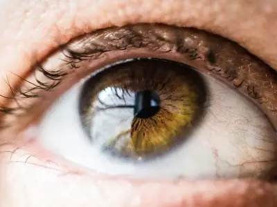 Specsavers Monklands launches new ZEST dry eye treatment service